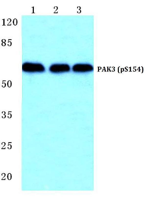 a03124s154 pak3 primary antiboties wb testing 1