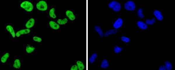 ICC staining FUBP1 in Hela cells (green)