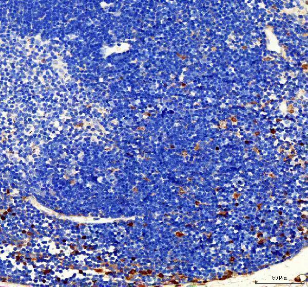 a03126 2 fubp1 primary antibodies ihc testing 2