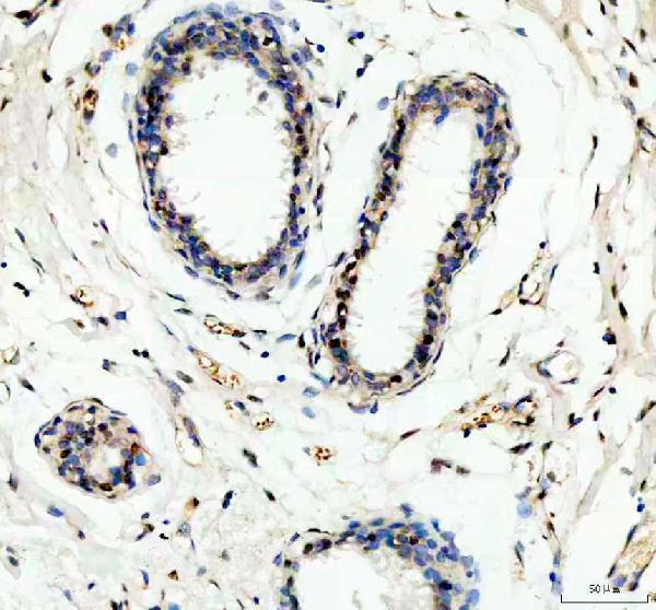a03126 2 fubp1 primary antibodies ihc testing 3