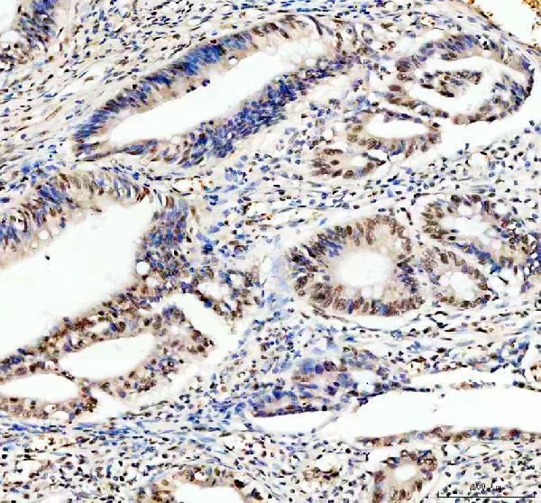 a03126 2 fubp1 primary antibodies ihc testing 4