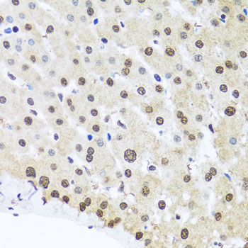 a03126 fubp1 primary antiboties ihc testing 2