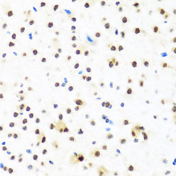 a03126 fubp1 primary antiboties ihc testing 4