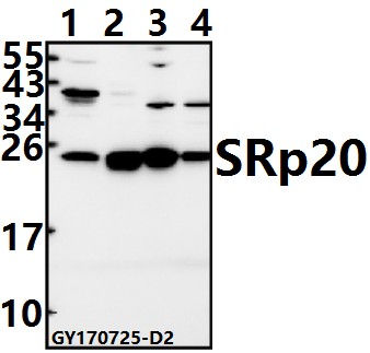 Western blot (WB) analysis of SRp20 (F151) pAb at 1:500 dilution
Lane1:U-87MG whole cell lysate(40ug)
Lane2:Jurkat whole cell lysate(40ug)
Lane3:C6 whole cell lysate(40ug)
Lane4:BV2 whole cell lysate(40ug)