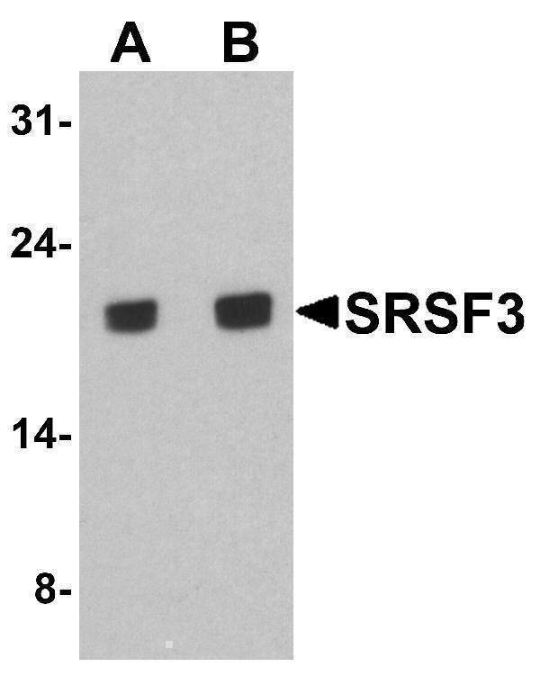 Western blot analysis of SRSF3 in K562 cell lysate with SRSF3 antibody at (A) 1 and (B) 2 μg/ml