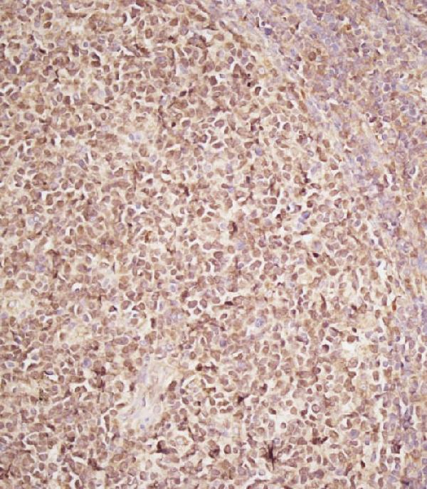 Immunohistochemical analysis of A03130-1 on paraffin-embedded Human tonsil tissue. Tissue was fixed with formaldehyde at room temperature. Heat induced epitope retrieval was performed by EDTA buffer (pH9. 0). Samples were incubated with primary antibody(1:100) for 1 hour at room temperature. Undiluted CRF Anti-Polyvalent HRP Polymer antibody was used as the secondary antibody.
