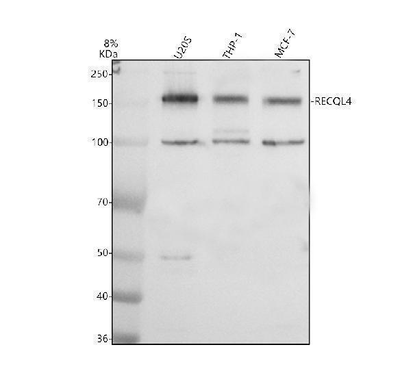 Western blot analysis of RECQL4 using anti-RECQL4 antibody (A03130-2)