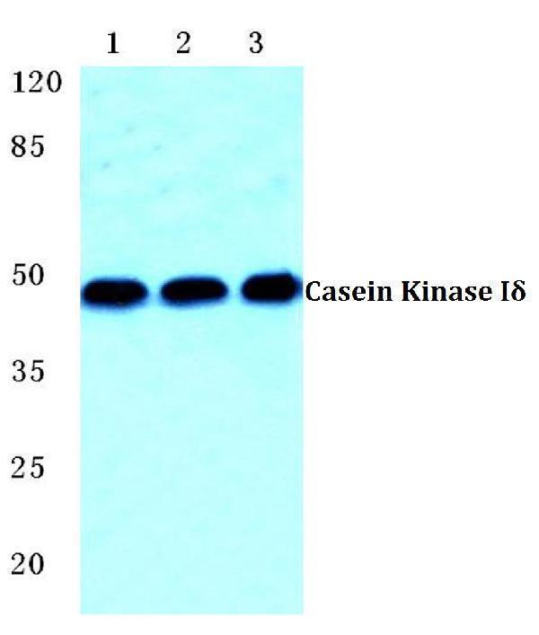 a03132 csnk1d primary antiboties wb testing 1