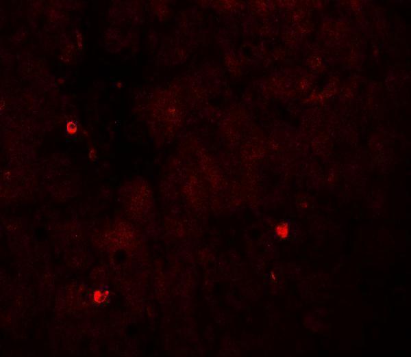 Immunofluorescence of TRIM33 in human liver tissue with TRIM33 antibody at 20 μg/ml