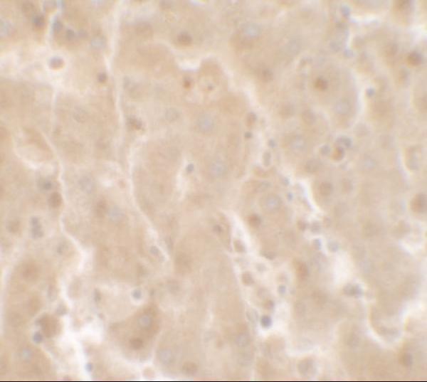 Immunohistochemistry of TRIM33 in human liver tissue with TRIM33 antibody at 2