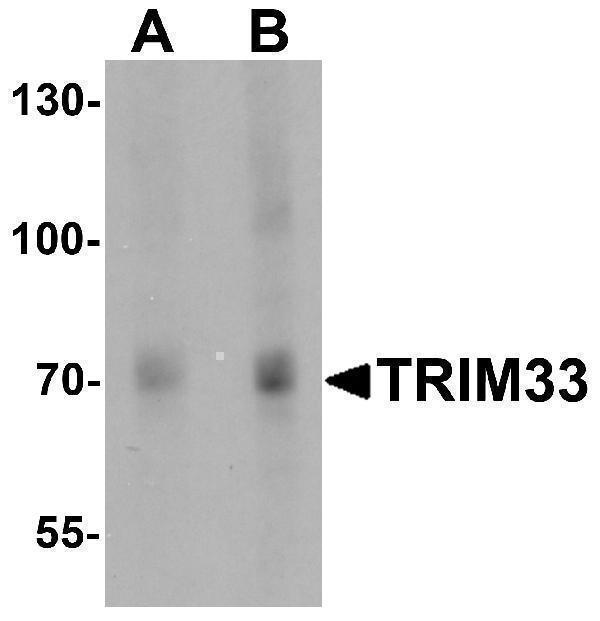 Western blot analysis of TRIM33 in human liver tissue lysate with TRIM33 antibody at (A) 1 and (B) 2 μg/mL