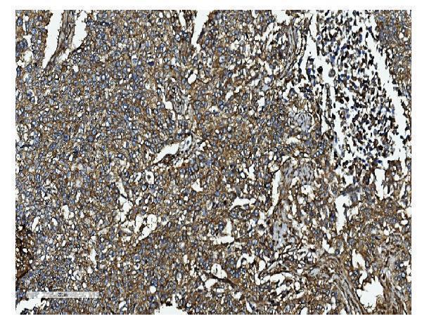  IHC analysis of Clathrin heavy chain/CLTC using anti-Clathrin heavy chain/CLTC antibody (A03134-1)