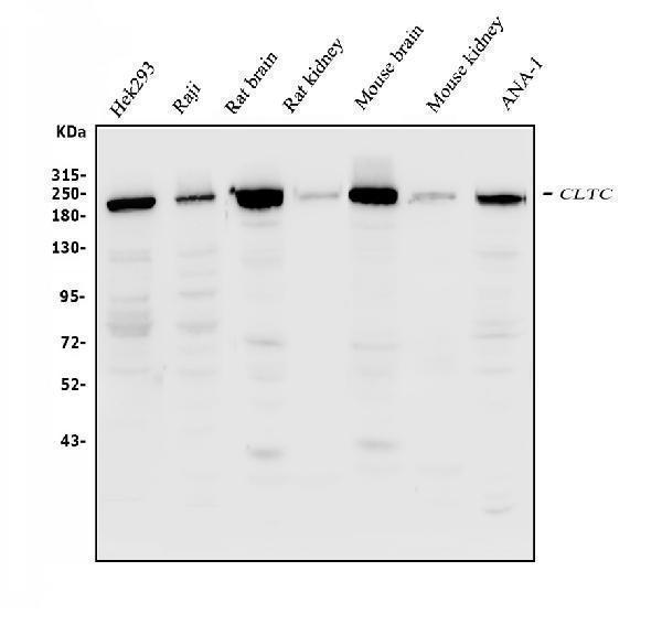  Western blot analysis of Clathrin heavy chain/CLTC using anti-Clathrin heavy chain/CLTC antibody (A03134-1)