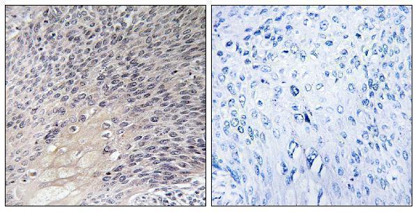 a03135 1 arhgdia primary antibodies ihc testing 1