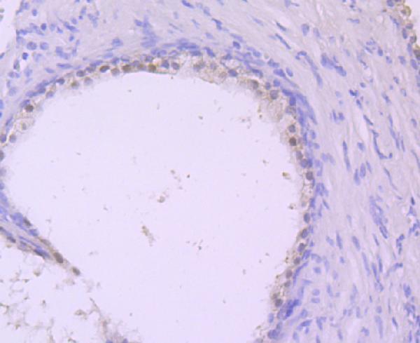 a03136 ddah1 primary antiboties ihc testing 2