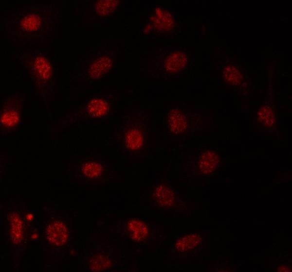  IF analysis of PRPF31 using anti-PRPF31 antibody (A03137-1)