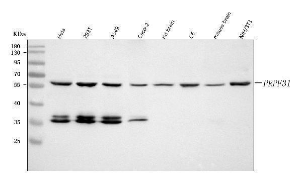  Western blot analysis of PRPF31 using anti-PRPF31 antibody (A03137-1)
