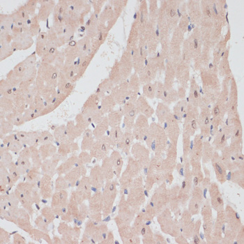 Immunohistochemistry of paraffin-embedded rat heart using PRPF31 antibody  at dilution of 1:100 