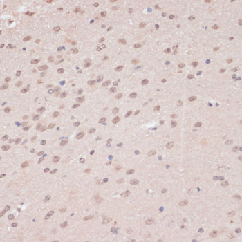 a03137 prpf31 primary antiboties ihc testing 4