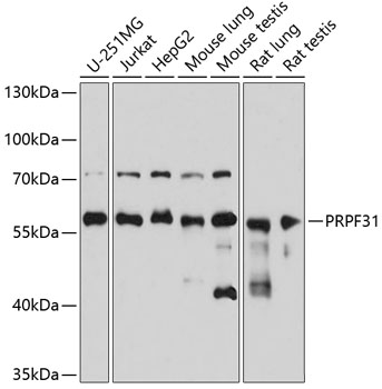 Western blot analysis of extracts of various cell lines, using PRPF31 antibody  at 1:3000 dilution
