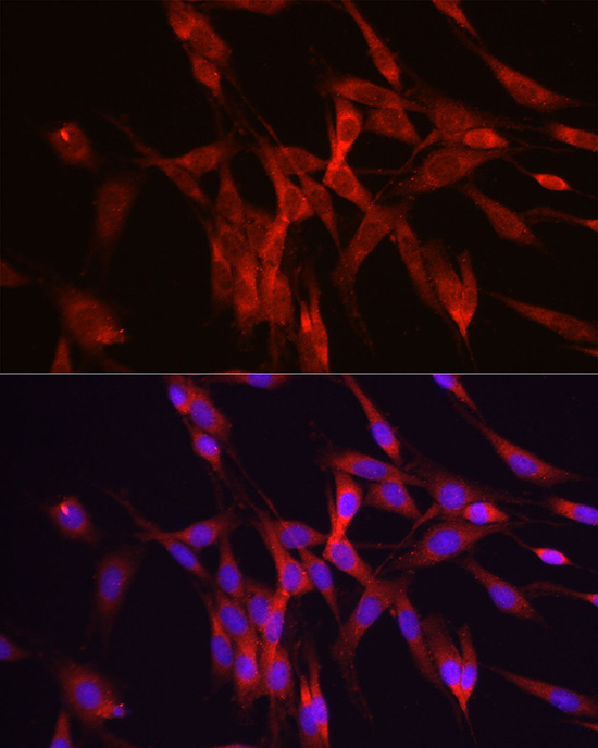 a03138 odc1 primary antiboties if testing 3