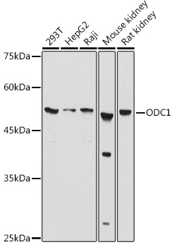a03138 odc1 primary antiboties wb testing 1