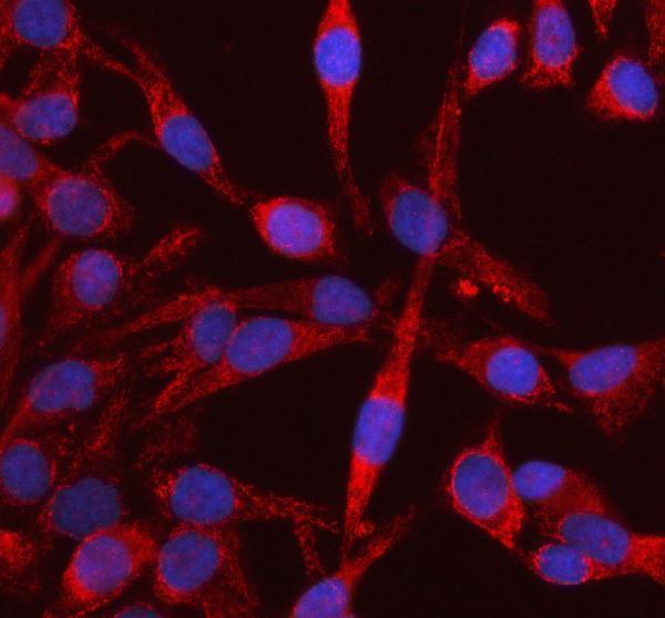  IF analysis of DKK3/RIG using anti-DKK3/RIG antibody (A03140)