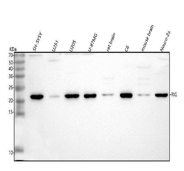  Western blot analysis of DKK3/RIG using anti-DKK3/RIG antibody (A03140)