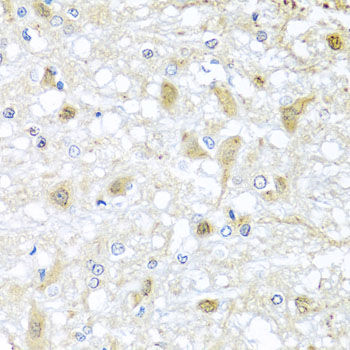 a03143 1 atp2c1 primary antiboties ihc testing 2