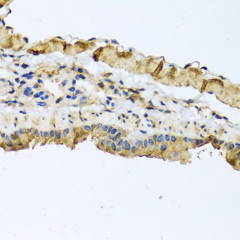 a03143 1 atp2c1 primary antiboties ihc testing 3