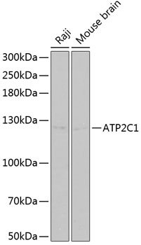 a03143 1 atp2c1 primary antiboties ihc testing 4