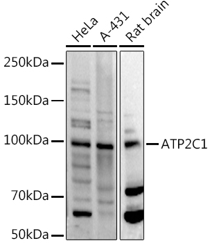 a03143 1 atp2c1 primary antiboties wb testing 1