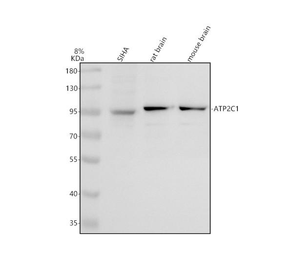 Western blot analysis of ATP2C1 using anti-ATP2C1 antibody (A03143-2)