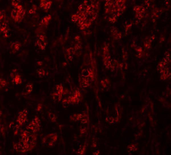 a03143 atp2c1 primary antibodies if testing 3