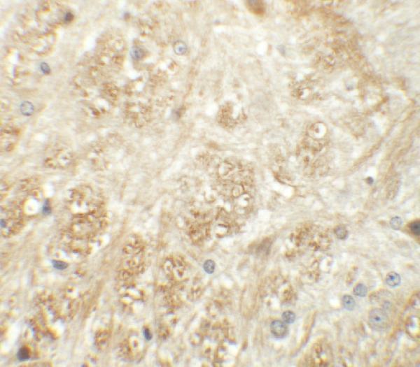a03143 atp2c1 primary antibodies ihc testing 2