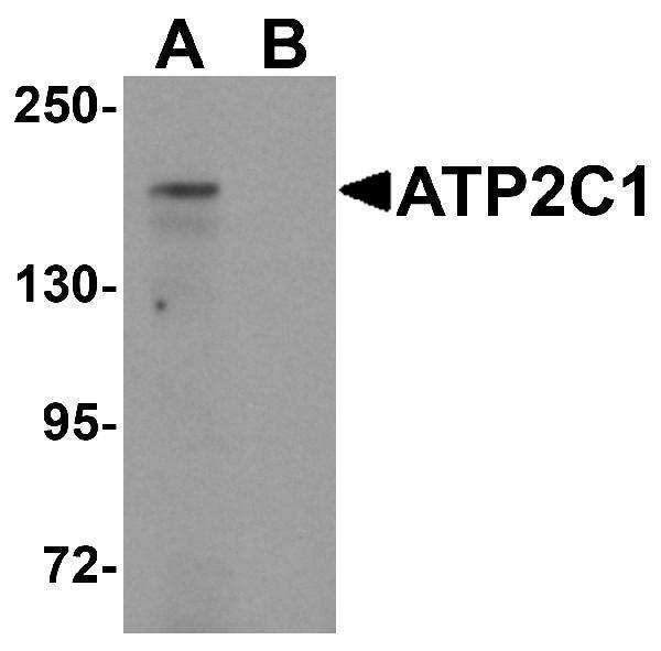 a03143 atp2c1 primary antibodies wb testing 1