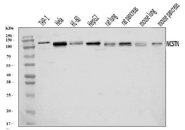  Western blot analysis of Nicastrin/NCSTN using anti-Nicastrin/NCSTN antibody (A03144-1)