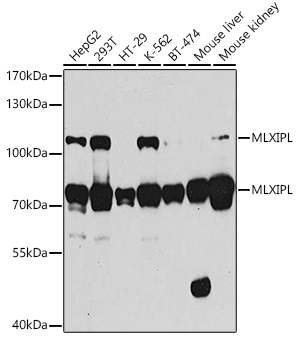 Western blot analysis of extracts of various cell lines, using MLXIPL antibody  at 1:1000 dilution