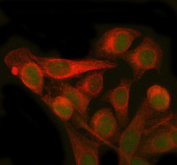a03146 1 pmm2 primary antibodies if testing 2