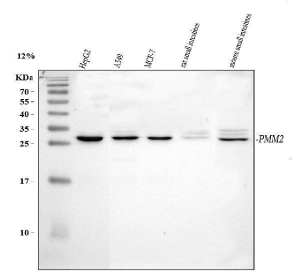 a03146 1 pmm2 primary antibodies wb testing 1