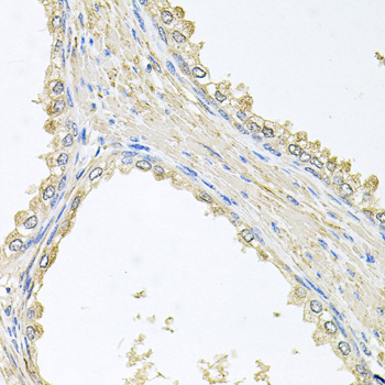 a03146 pmm2 primary antiboties if testing 2