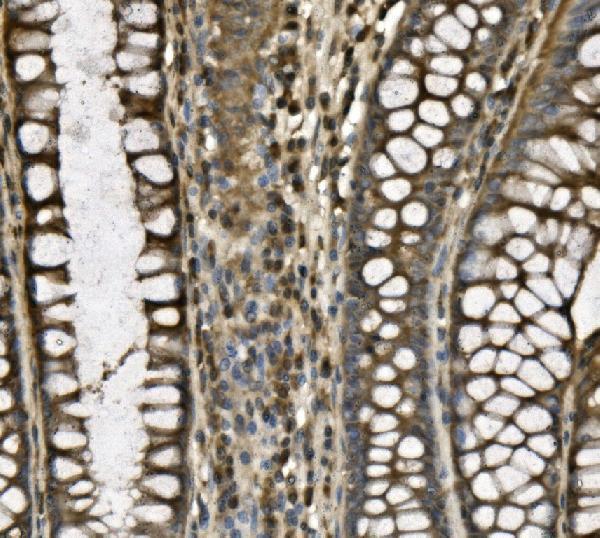  IHC analysis of CD239/BCAM using anti-CD239/BCAM antibody (A03148-1)