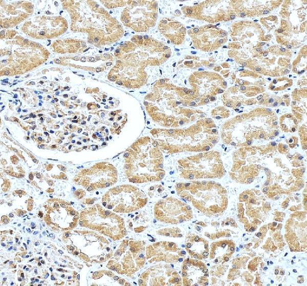 IHC analysis of BCAM using anti-BCAM antibody (A03148-1)