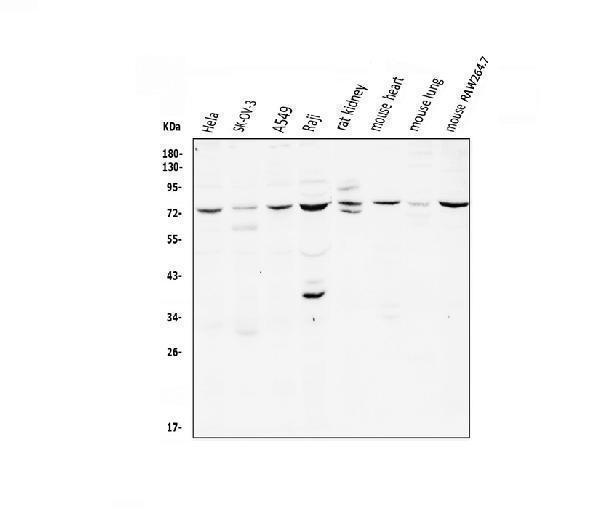  Western blot analysis of CD239/BCAM using anti-CD239/BCAM antibody (A03148-1)