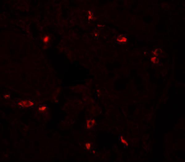 Immunofluorescence of BTLA in human small intestine tissue with BTLA antibody at 20 μg/mL