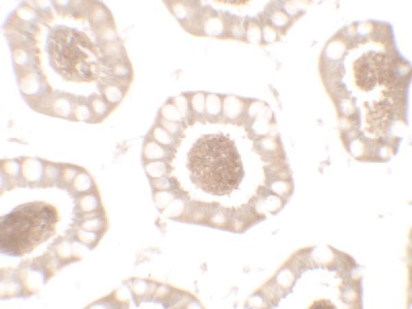 Immunohistochemistry of BTLA in human small intestine tissue with BTLA antibody at 2