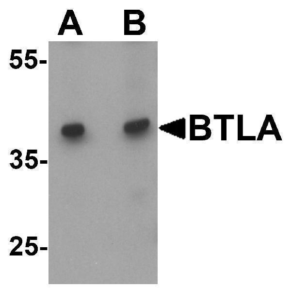 Western blot analysis of BTLA in Jurkat cell lysate at (A) 1 and (B) 2 μg/ml