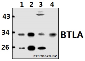 Western blot (WB) analysis of CD272 polyclonal antibody at 1:500 dilution
Lane1:HCT116 whole cell lysate(20ug)
Lane2:L02 whole cell lysate(20ug)
Lane3:C6 whole cell lysate(40ug)
Lane4:CT26 whole cell lysate(40ug)