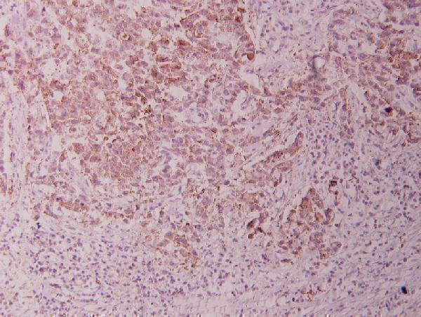 a03152 1 gsk3a primary antiboties ihc testing 2