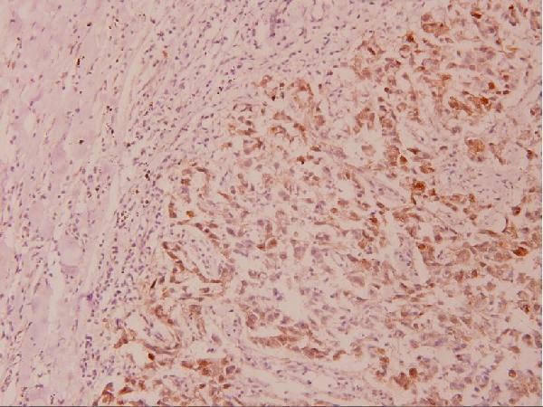 a03152s21 gsk3a primary antiboties ihc testing 2